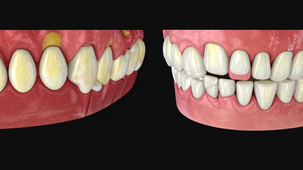 retained and dystopian tooth