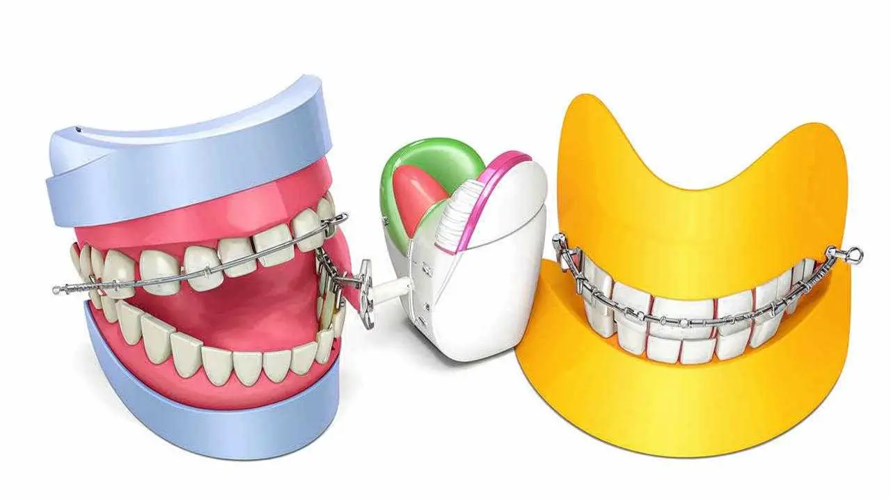 methods of distal bite correction