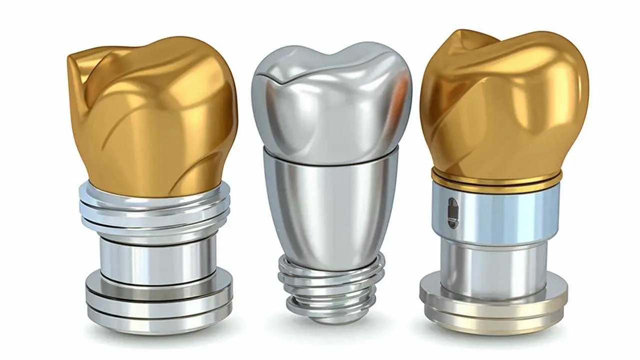 xive custom abutments