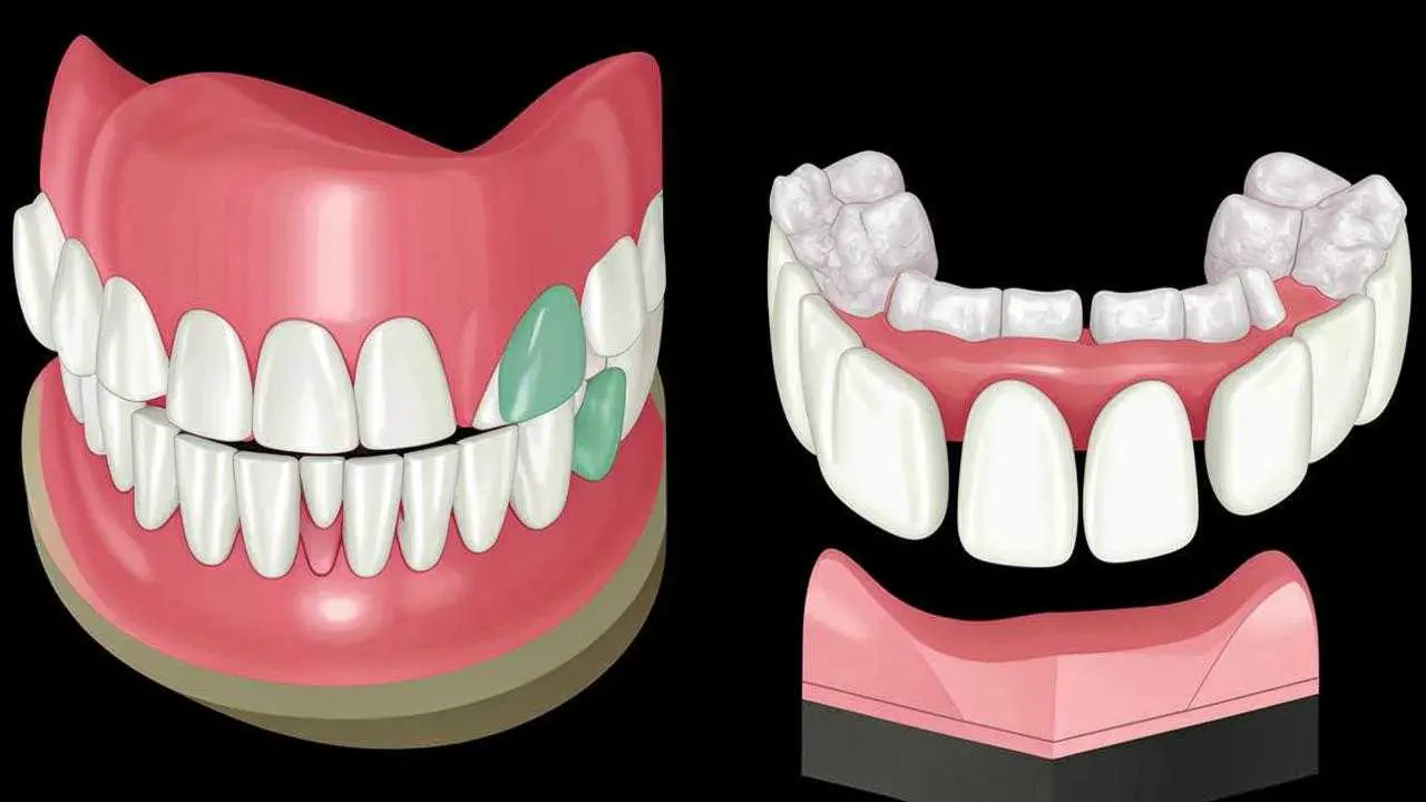 the effects of a missing tooth