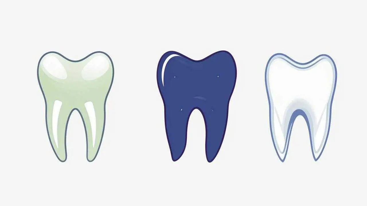 fixed mandibular prostheses