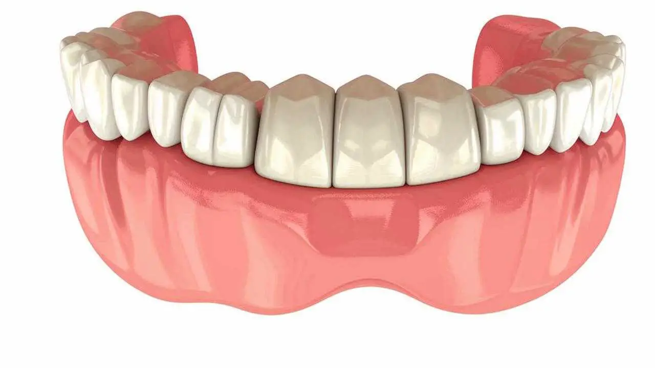 types of prosthetics for missing teeth