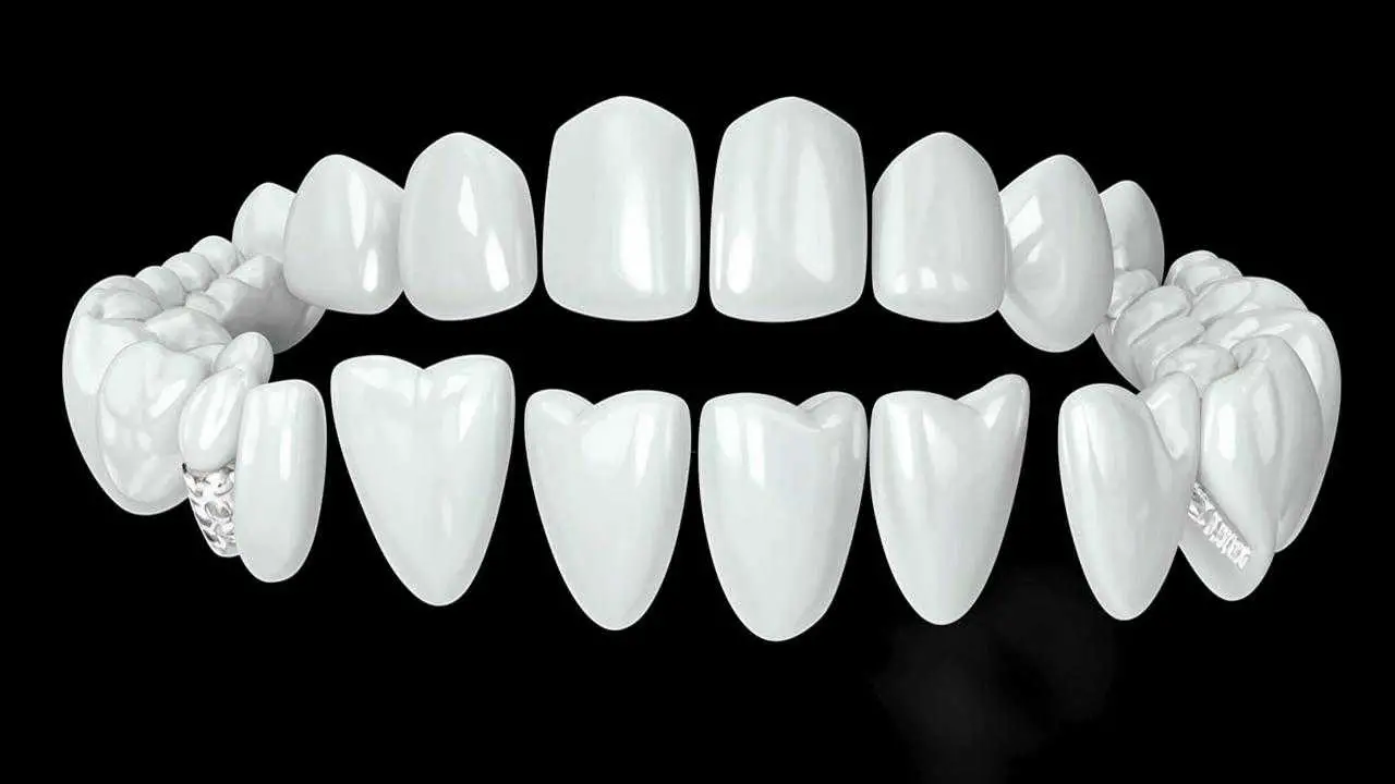 all-ceramic crowns