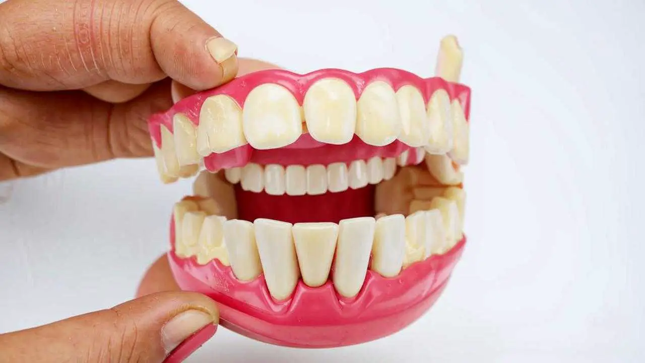 removable combined denture