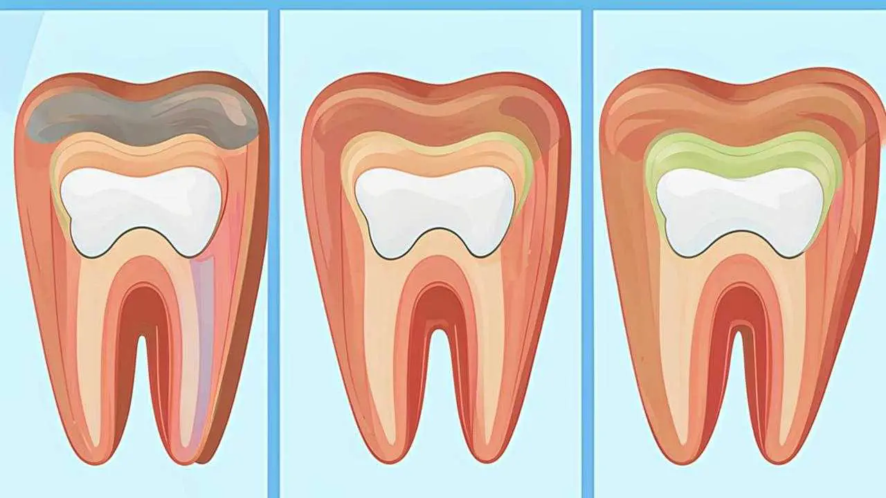 signs of gum inflammation