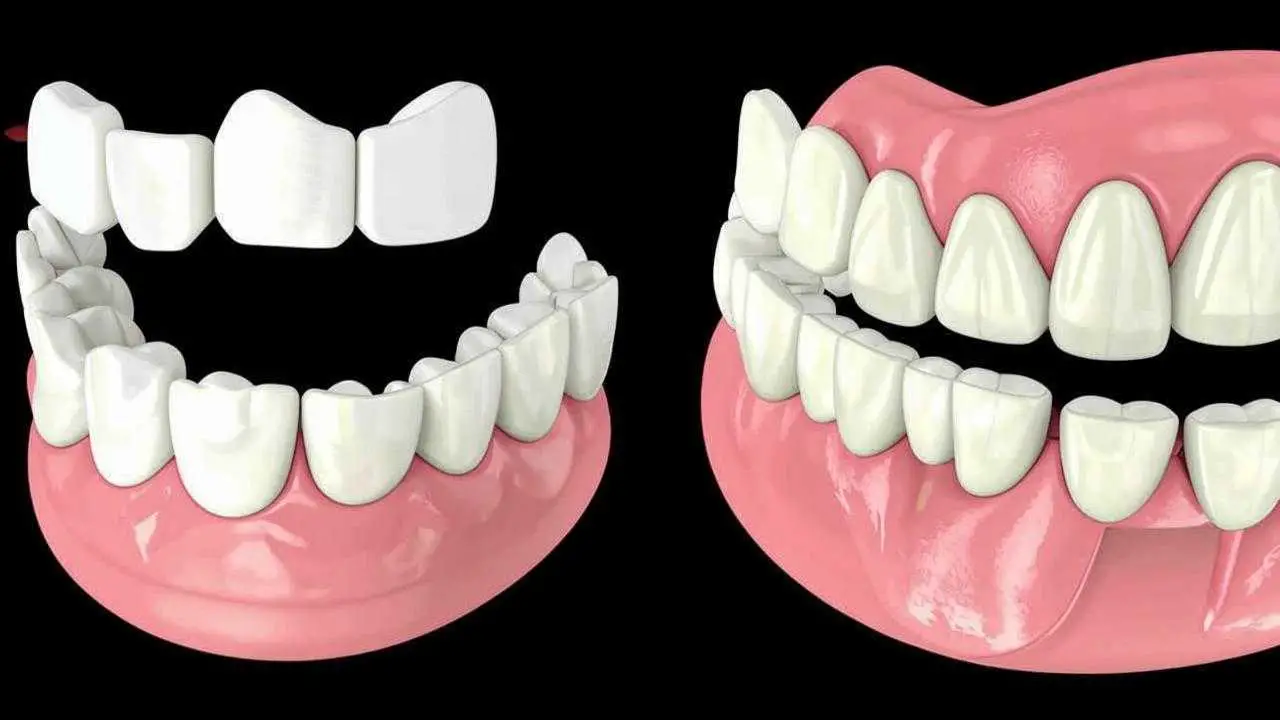 denture photo