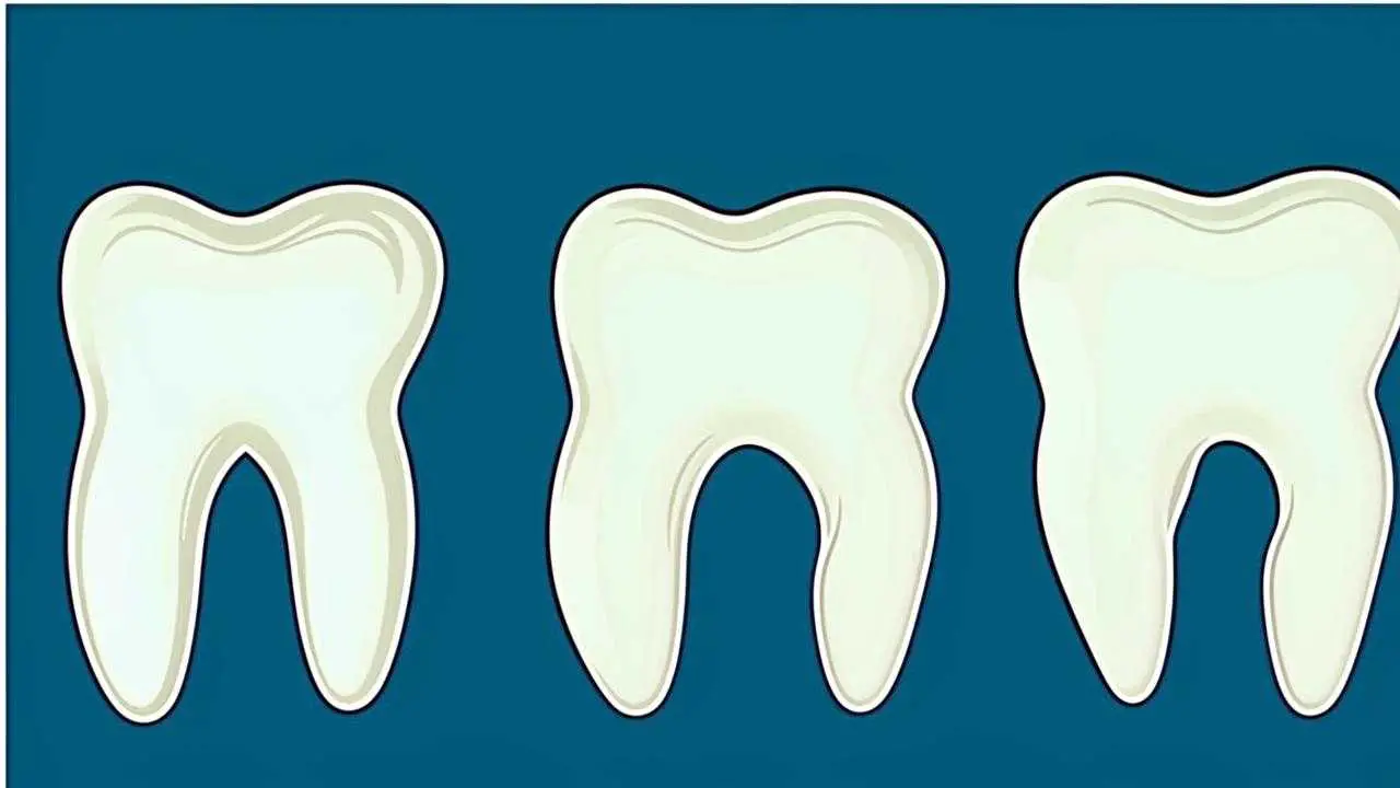 wisdom teeth complications