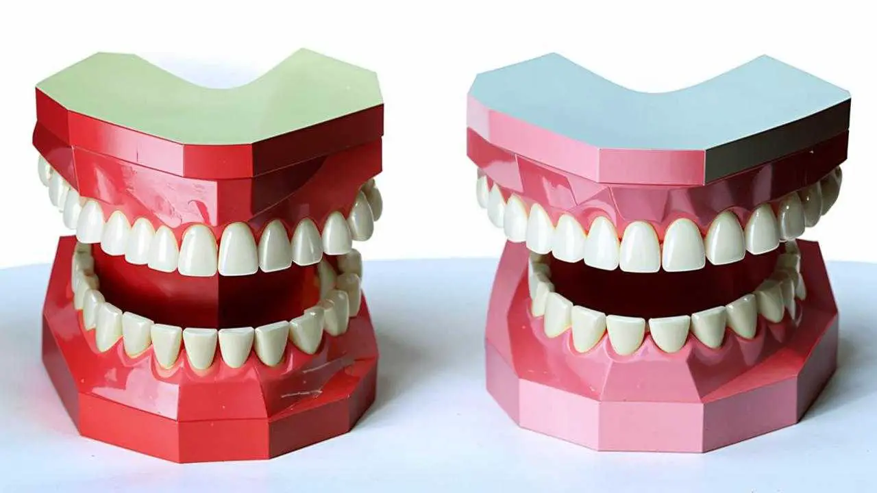 dental splinting