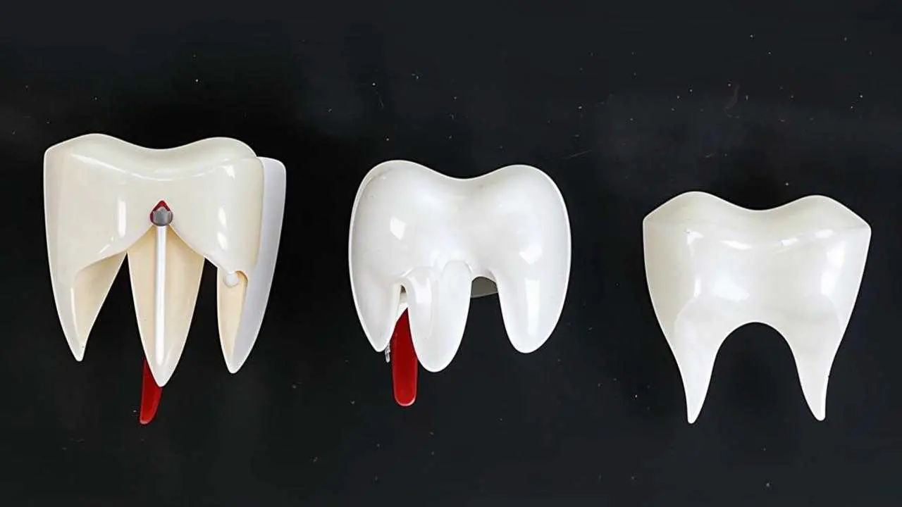 removable dentures for lower teeth