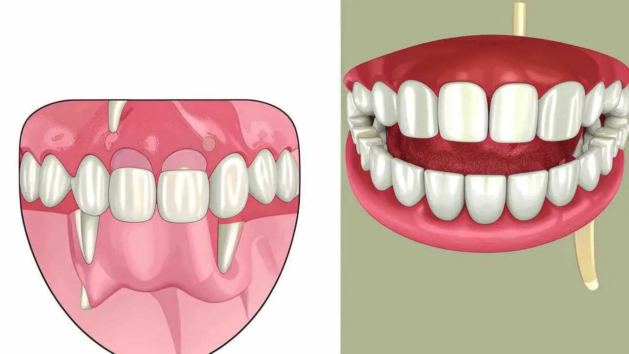 denture photo