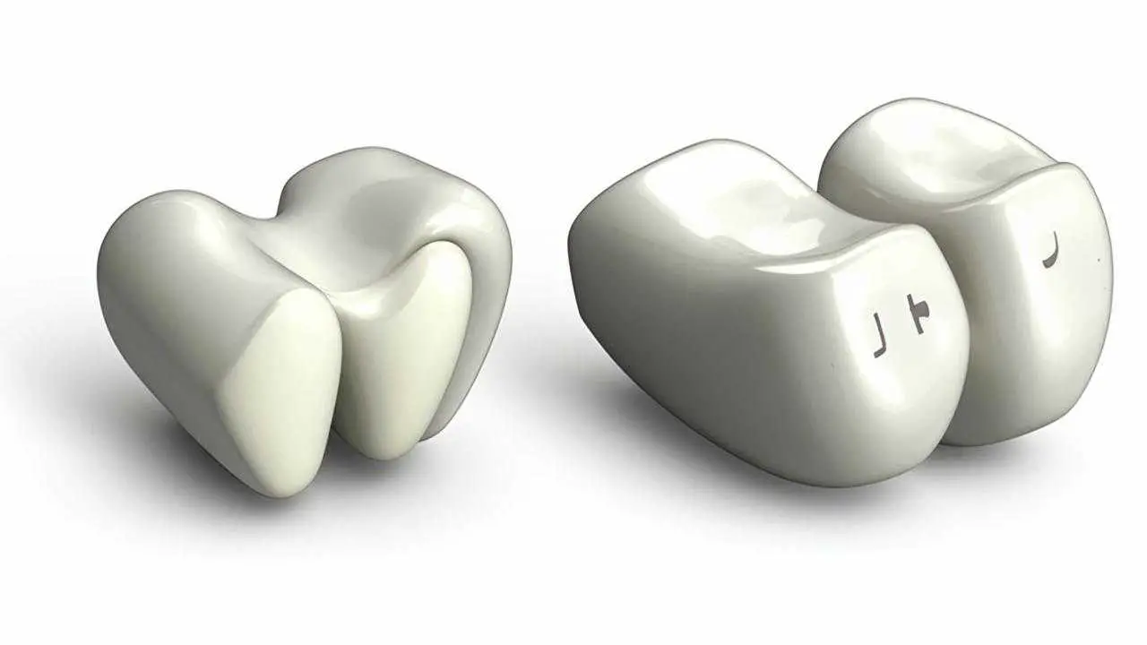 Dental inlays and posts