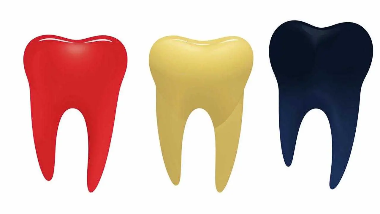 types of tooth dislocations