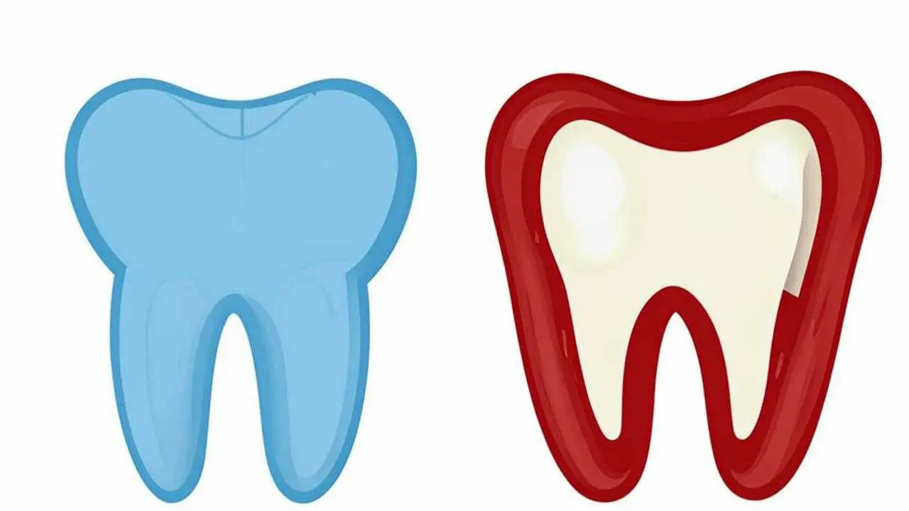 periodontal disease